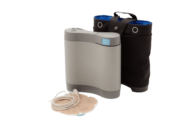 Optune Pack Optune Gio™ | Terapia TTFields para pacientes con GBM