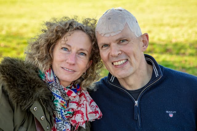 Optune Gio™ | Terapia TTFields para pacientes con GBM